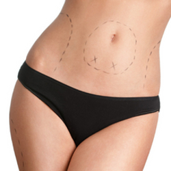 Effective Package for Gastric Sleeve Surgery in Merida, Mexico