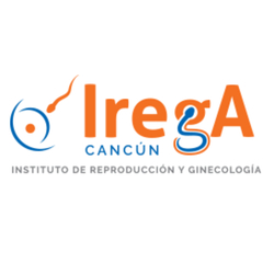 IREGA IVF Cancun