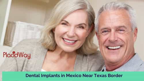 Dental-Implants-in-Mexico-Near-Texas-Border