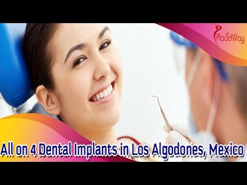 All-on-4 Dental Implants - Mouth Makeover in Los Algodones, Mexico 