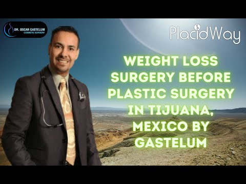 Weight Loss Surgery Before Plastic Surgery in Tijuana Mexico at Gastelum Clinic