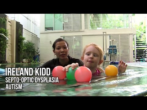 Stem Cell Therapy for Autism in Bangkok, Thailand – Ireland Testimonial