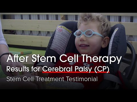 Stem Cell for Cerebral Palsy in Bangkok, Thailand – Aleksnader Testimonial