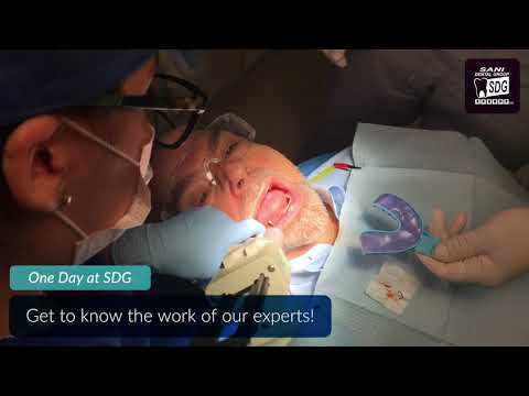 Dental Implants in Los Algodones- A Day at Sani Dental Group, Mexico