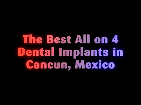 The Best All on 4 Dental Implants in Cancun, Mexico