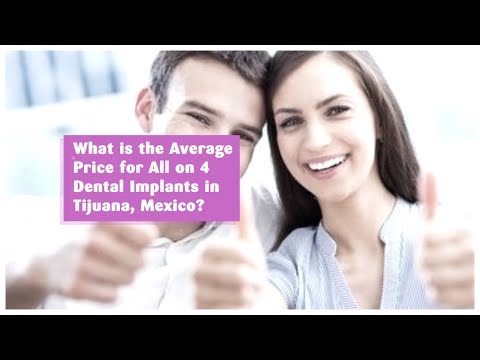 What is the Average Price for All on 4 Dental Implants in Tijuana, Mexico?