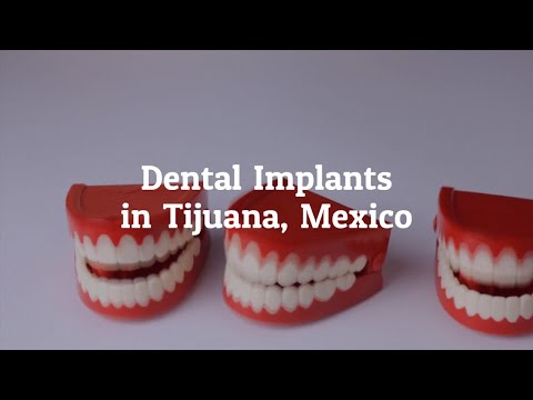 Why Go for Dental Implants in Tijuana, Mexico?