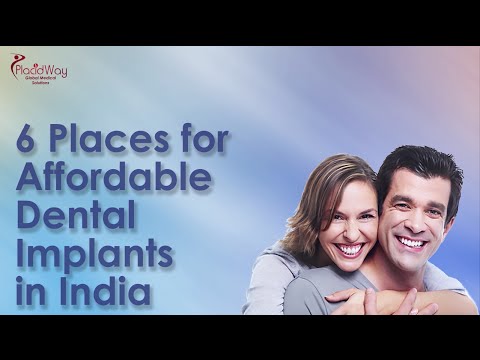 Top Places for Affordable Dental Implants in India