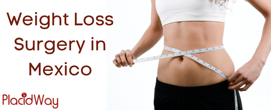 Weight Loss Surgery in Mexico