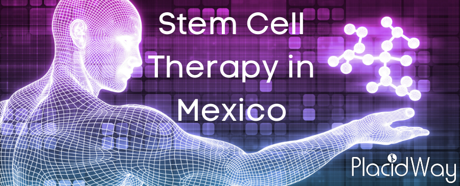 Stem Cell Therapy in Mexico - Safe and Low-Cost