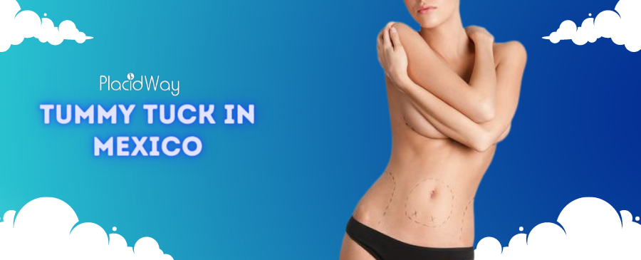Refine Your Figure with Tummy Tuck in Mexico
