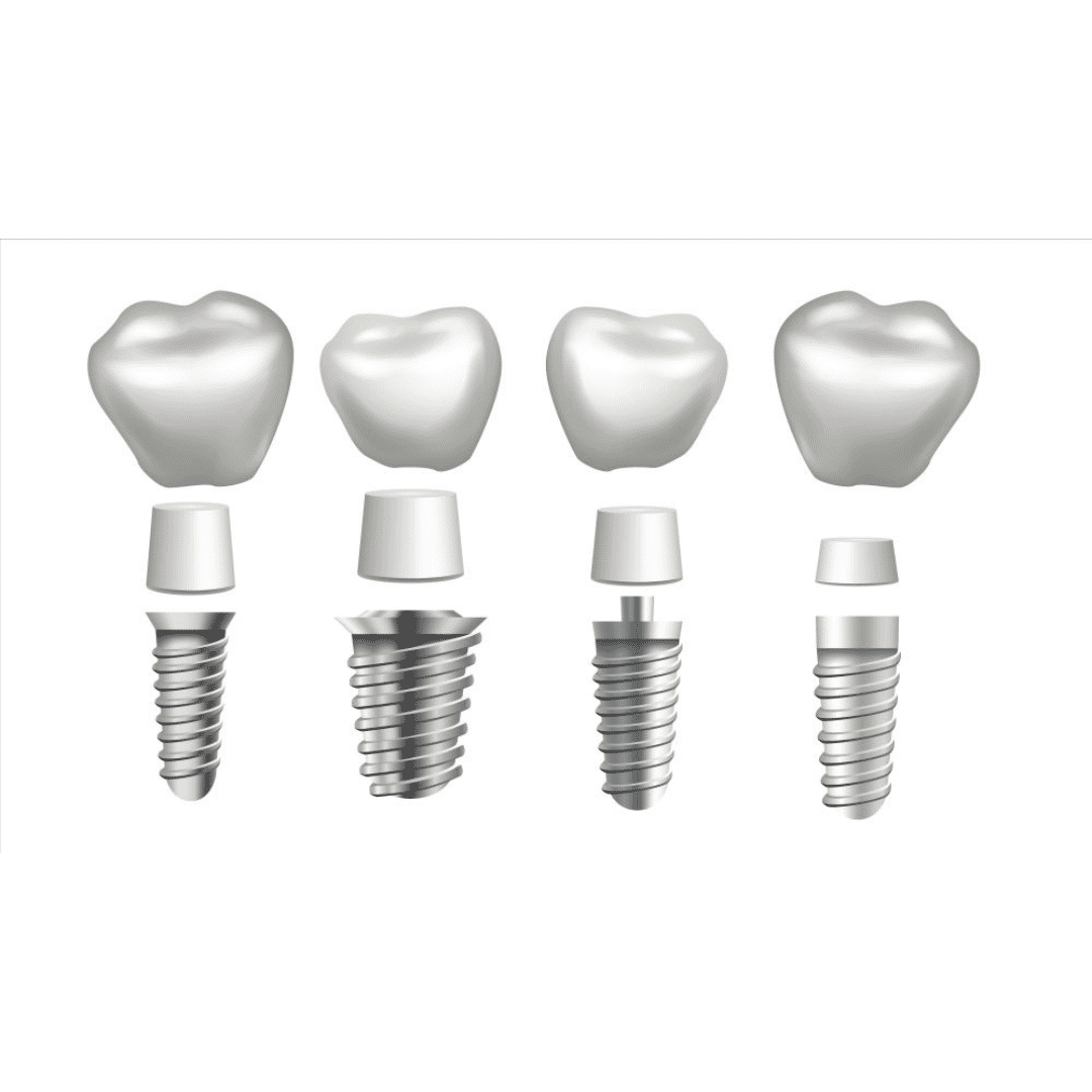 All on 4 Dental Implants in India